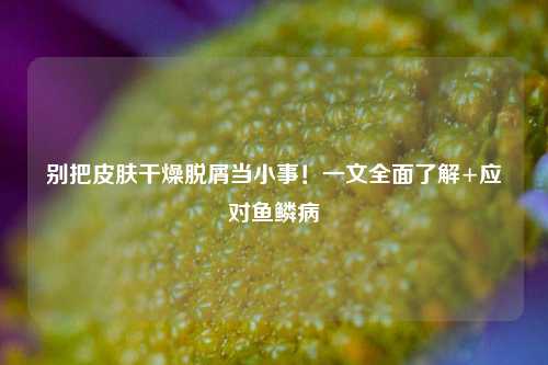 别把皮肤干燥脱屑当小事!一文全面了解+应对鱼鳞病